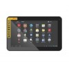 Simmtronics Xpad X1010 Spare Parts & Accessories